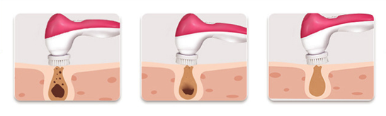 3D電動深層清潔面刷 手動潔面刷 超軟3D軟毛潔淨洗臉刷潔面器 矽膠清潔雙面按摩潔面刷 洗面器 洗面刷 - 粉紅色 電動洗臉刷 多功能洗臉儀 潔臉刷多功能美容儀潔面儀按摩器潔面儀