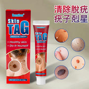 去疣膏20g 天然手足臉部除疣膏 身體除痣護理膏 腋下除疣去痣膏 淡化肉痣修護膏