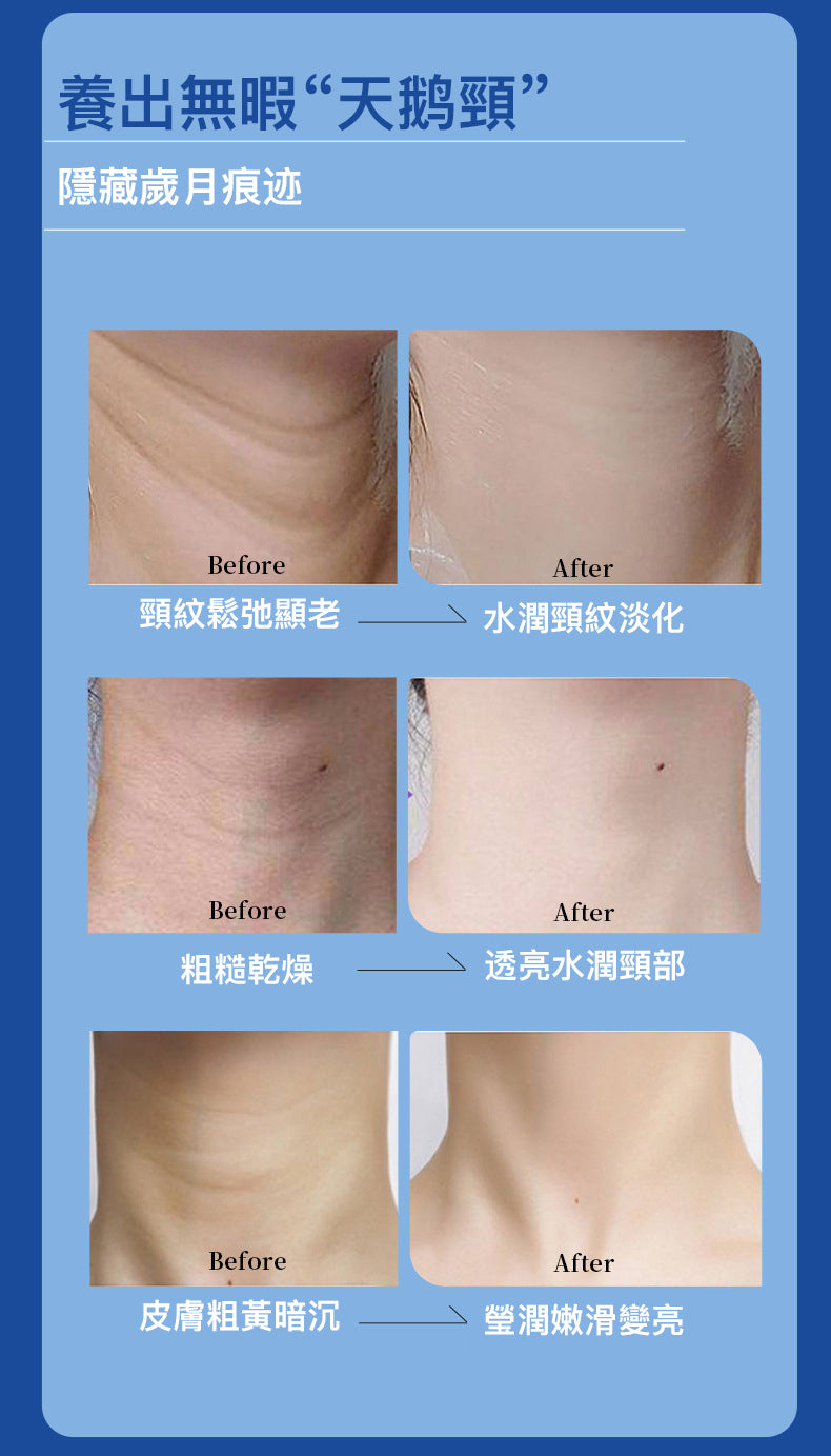 膠原蛋白頸膜 提拉緊緻脖子 淡化頸紋 多肽面膜頸部護 理頸膜貼 10片