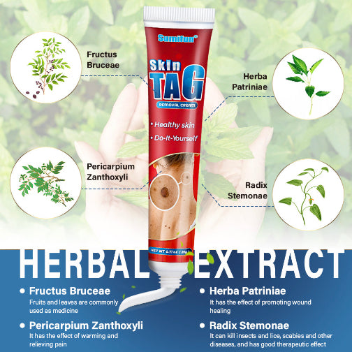 Wart removal cream 20g natural hands, feet, face wart removal cream, body mole removal care cream, armpit wart removal and mole removal cream, lightening flesh mole repair cream