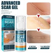 Scar Removal Gel Scar Removal Postpartum Stretch Mark Scar Surgical Repair Cream 50ml