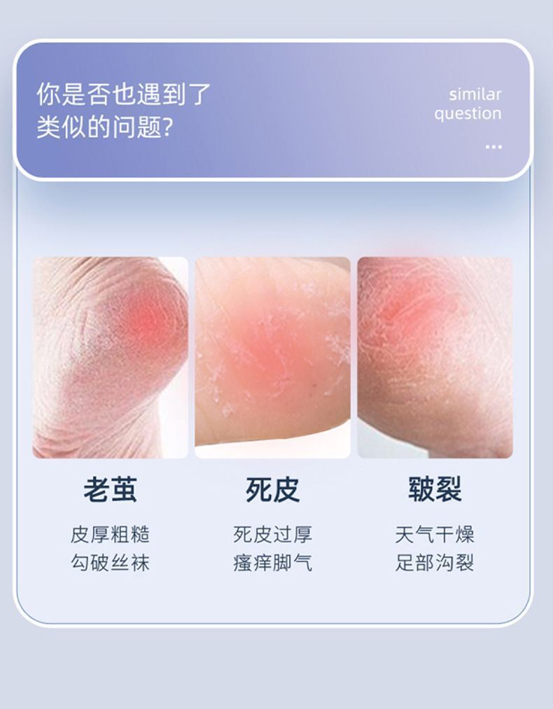 HK250702JJQT15020RMN01_3