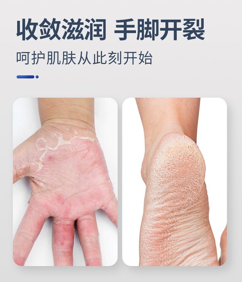 HK250702JJQT15082RMN01_2