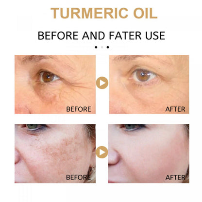 Turmeric anti-spot, anti-wrinkle, whitening, firming, firming and moisturizing essence 30ml