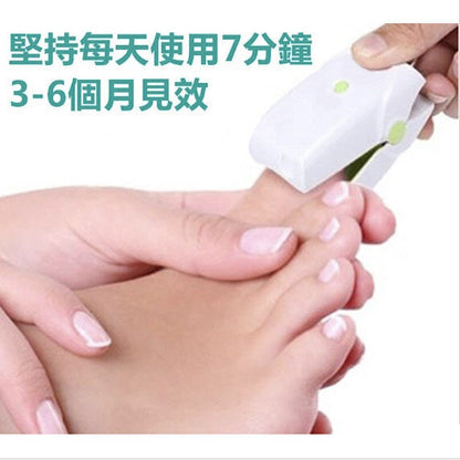 Onychomycosis machine laser treatment device to repel onychomycosis | non-drug | improve the appearance of onychomycosis | onychomycosis | hand nails | toe nails | natural manicure | onychomycosis