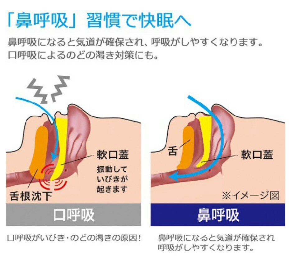 防打呼噜张口呼吸说梦话鼾带日式下巴托带防止鼾带打呼噜绷带止鼾带紧致提拉睡眠瘦脸带防止口呼吸张口睡觉防止打呼消打鼾神器打呼正品成人夜间耳鼻喉