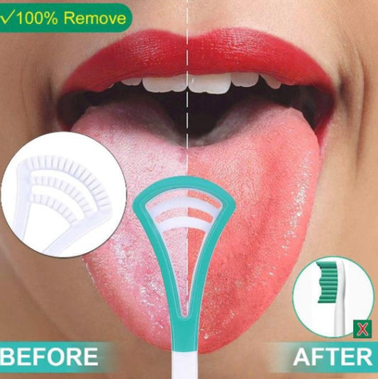 Tongue cleaning scraper (random color)