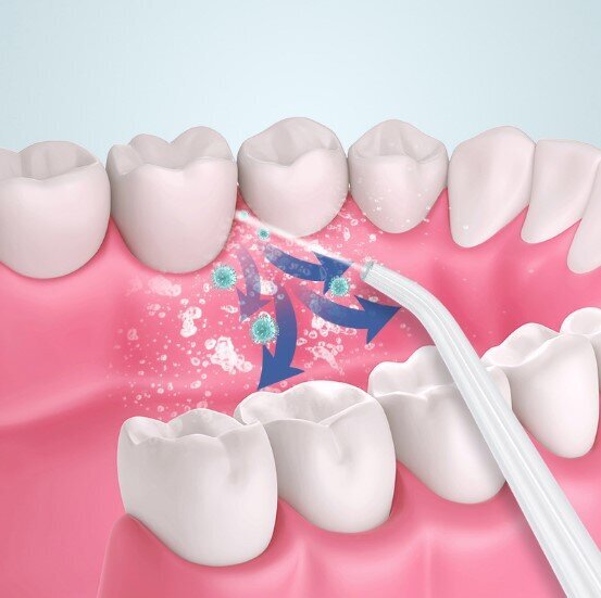 電動水牙線 衝牙器 智能洗牙器 X3噴頭-白色 水牙線