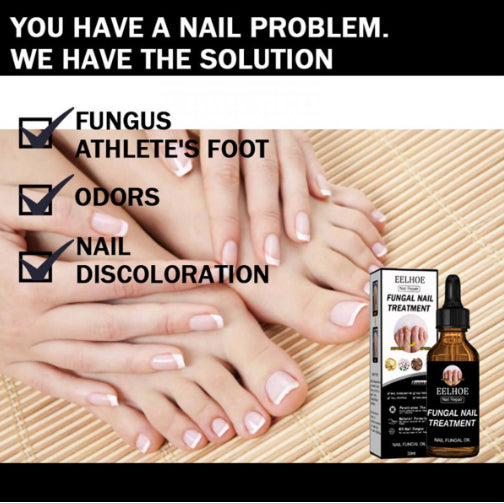 Nail Repair Onychomycosis 30ml Onychomycosis Toenails Hand Nails Healthy Manicure (Onychomycosis Savior Targets Fungus)