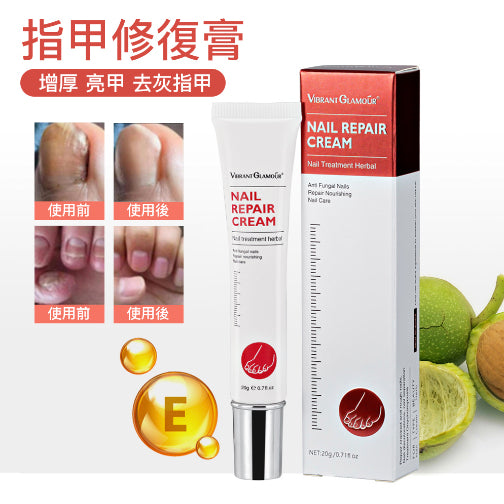 Onychomycosis Nemesis Onychomycosis Tohui Nail Repair Cream softens nails, removes thick nails, brightens nails, and is antibacterial for hands and feet 20g