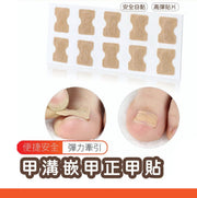 10貼一張免膠水正甲貼腳趾甲甲溝嵌甲矯正器拉拉貼片修腳工具 免膠 甲溝嵌甲正甲貼 正甲貼 甲溝嵌 甲矯正器 腳趾甲貼 美甲貼 歐文購物