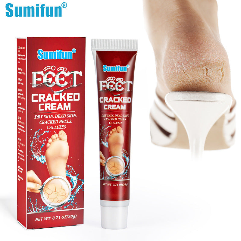 sumifun chapped hands and feet cream dry cracked cracks cream body lotion