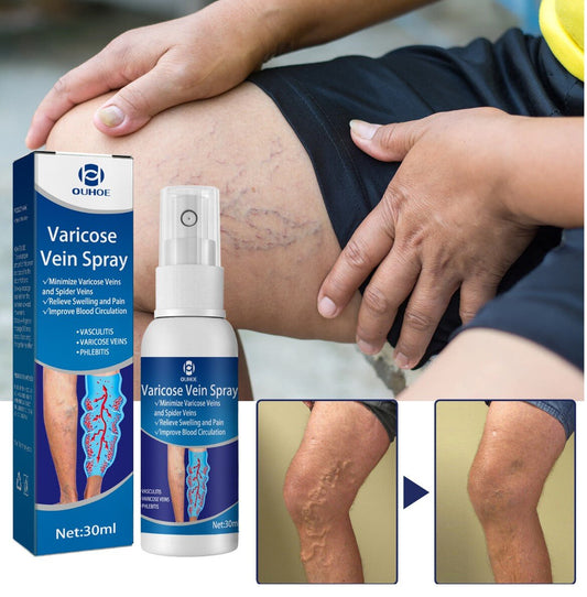 Vein massage varicose veins varicose veins leg bulging veins calf swelling earthworm legs leg varicose veins varicose veins ointment muscle soreness massage cream