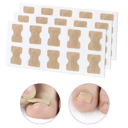 [Pack of 5] Glue-free nail correction patch, nail groove ingrown toenail corrector, toenail patch, nail patch, nail care