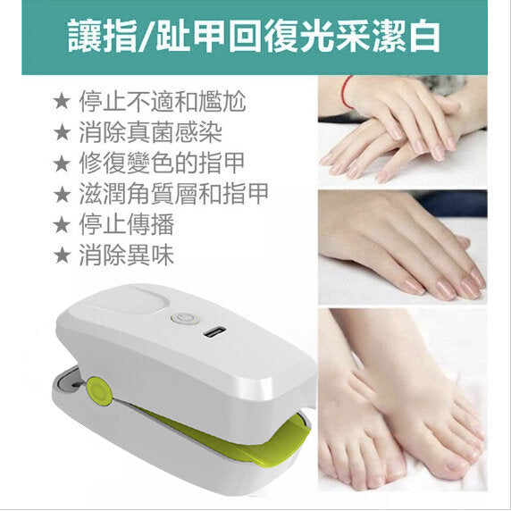 Onychomycosis machine laser treatment device to repel onychomycosis | non-drug | improve the appearance of onychomycosis | onychomycosis | hand nails | toe nails | natural manicure | onychomycosis