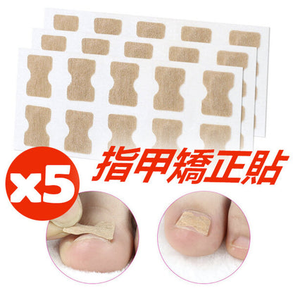 [Pack of 5] Glue-free nail correction patch, nail groove ingrown toenail corrector, toenail patch, nail patch, nail care